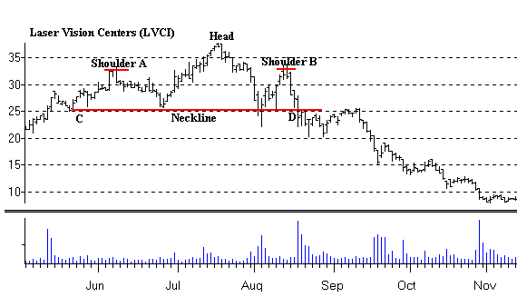 C Stock Chart Example